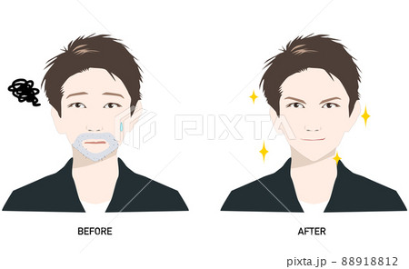 青髭に悩む男性ビフォーアフター__メンズスキンケア 88918812