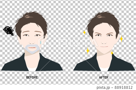 青髭に悩む男性ビフォーアフター__メンズスキンケア 88918812