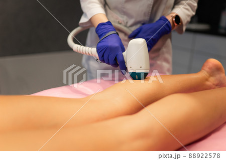 Laser depilation leg hair removal therapy 88922578