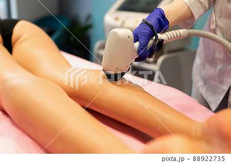Laser depilation leg hair removal therapy 88922735