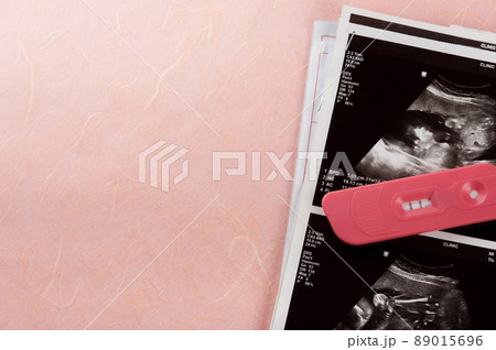the pregnancy test 89015696