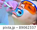 Dentist applies whitening gel to patient's teeth in dental clinic. 89062337