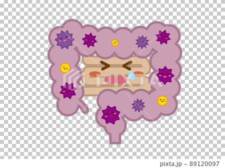 Unhealthy large intestine 89120097