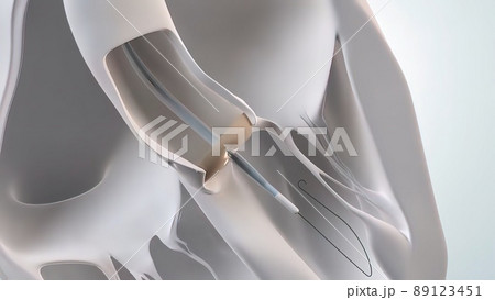 The Cardiovascular System. 3D Medical 3D Render of the Aortic Valve Expansion 89123451