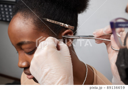 Close up of woman's ear with pierced on her ear for treatment of the pain some place on her body by Chinese doctor. 89136659
