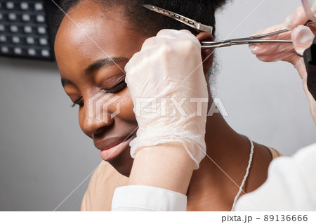 Close up of woman's ear with pierced on her ear for treatment of the pain some place on her body by Chinese doctor. Close up of woman's ear with pierced on her ear for treatment of the pain some place on her body by Chinese doctor. 89136666