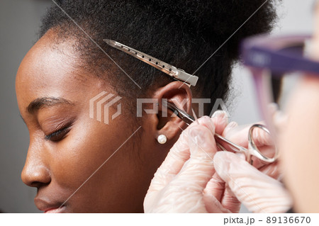 Close up of woman's ear with pierced on her ear for treatment of the pain some place on her body by Chinese doctor. 89136670