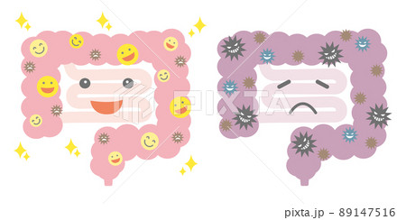 健康な大腸と不健康な大腸 腸活 健康な大腸と不健康な大腸 腸活 89147516