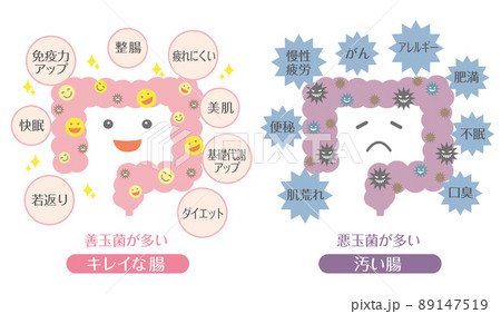 腸活イラスト　善玉菌が多い腸　悪玉菌が多い腸 89147519