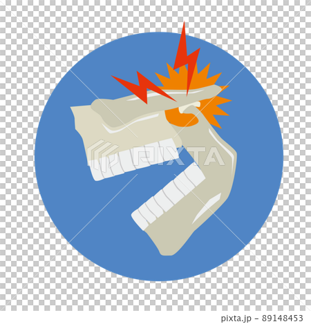 顎関節症のイメージ 顎関節症のイメージ 89148453