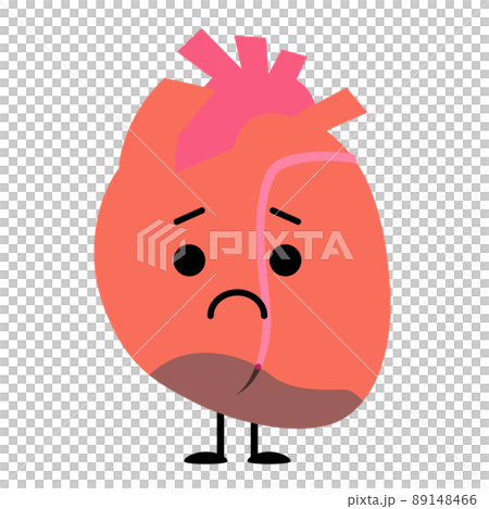 Heart where myocardium is necrotic due to myocardial infarction 89148466