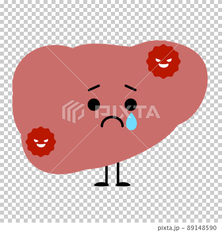 癌ができてしまった肝臓 89148590