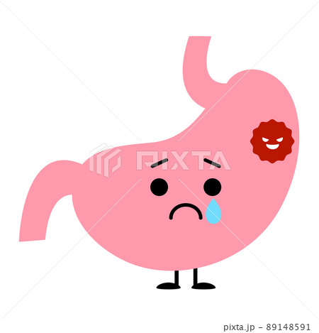 癌ができてしまった胃 89148591