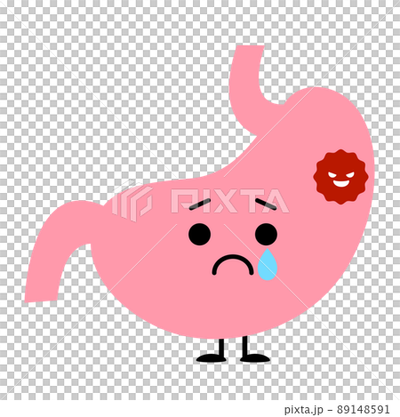 癌ができてしまった胃 89148591