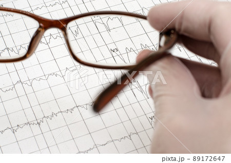 The hand in the white medical glove holds the glasses. Electrocardiogram graph (ECG) 89172647