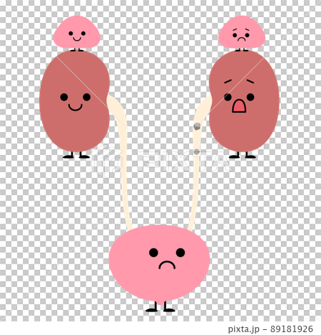 泌尿小組擔心輸尿管結石的移動 泌尿小組擔心輸尿管結石的移動 89181926