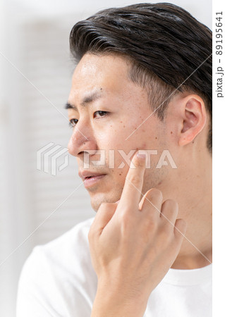 メンズビューティー　肌荒れ　ニキビ　ヒゲ 89195641