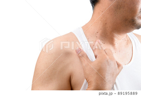 Middle aged man in white veat point to Skin Tags or Acrochordon on his neck 89195889