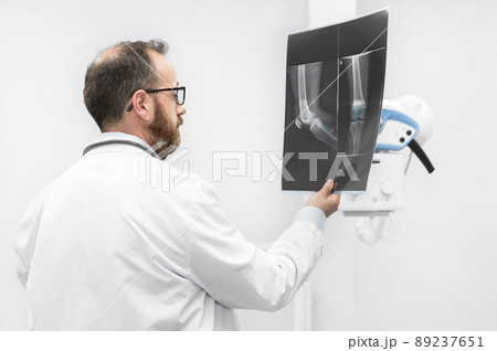 Doctor examine a film x-ray of a patient at radiology room. 89237651