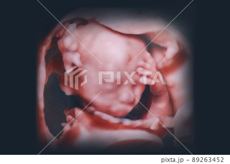 胎児の3D画像　赤ちゃん 89263452