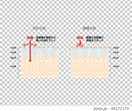 荒れた肌と健康な肌 30日サイクル 荒れた肌と健康な肌 30日サイクル 89272179
