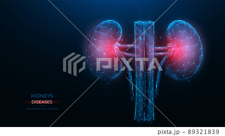 Polygonal vector illustration of an inflamed human kidney on a dark blue background. Diseases of the organs of the excretory system concept. Urological or nephrological template, or banner. 89321839