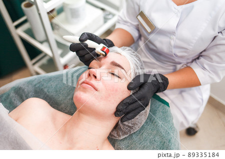 Doctor cosmetologist makes facial massage procedure using a dermo roller. Woman in beauty salon during mesotherapy procedure with mesoscooter.. 89335184