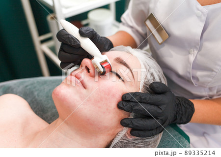 Doctor cosmetologist makes facial massage procedure using a dermo roller. Woman in beauty salon during mesotherapy procedure with mesoscooter Doctor cosmetologist makes facial massage procedure using a dermo roller. Woman in beauty salon during mesotherapy procedure with mesoscooter 89335214
