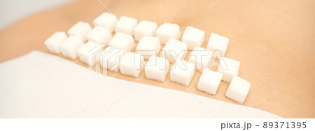 The concept of epilation, waxing, and intimate hygiene. Sugar cubes lying in a row on the bikini zone of a young white woman, close up The concept of epilation, waxing, and intimate hygiene. Sugar cubes lying in a row on the bikini zone of a young white woman, close up 89371395
