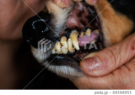 歯石の付いた犬の歯 89398955
