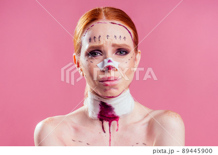 Patient in bandages. Nurses and young woman in studio pink background 89445900