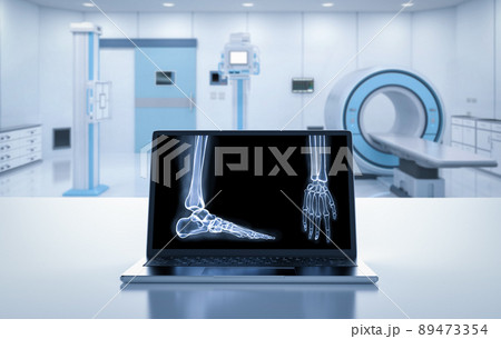 Hospital radiology room with computer notebook display x-ray film Hospital radiology room with computer notebook display x-ray film 89473354