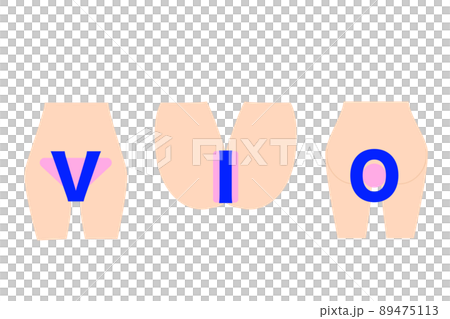 VIO hair removal. Hair loss site in the delicate zone. 89475113