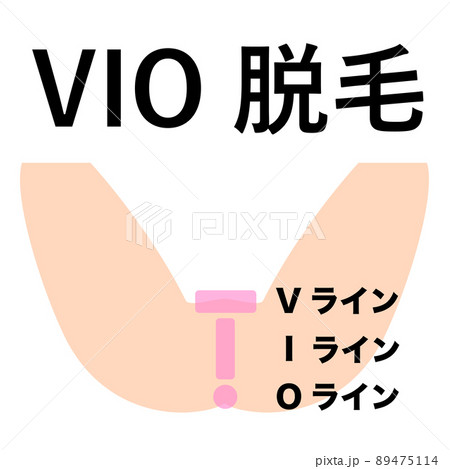 VIO脱毛。デリケートゾーンの脱毛部位の図解。 89475114