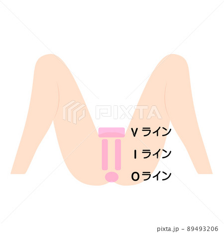VIO脱毛。デリケートゾーンの脱毛部位の図解。 89493206