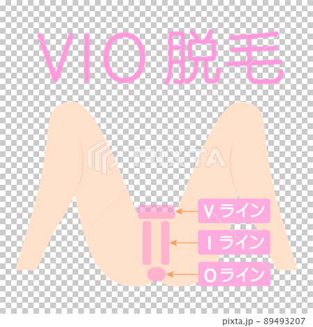 VIO脱毛。デリケートゾーンの脱毛部位の図解。 VIO脱毛。デリケートゾーンの脱毛部位の図解。 89493207
