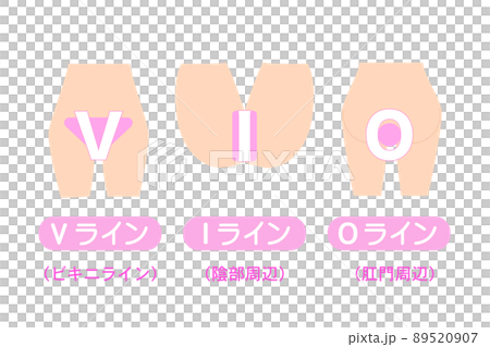 VIO脱毛。デリケートゾーンの脱毛部位の図解。 89520907