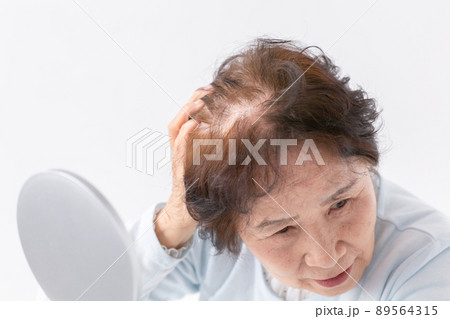 髪を気にする女性　シニア　薄毛 89564315
