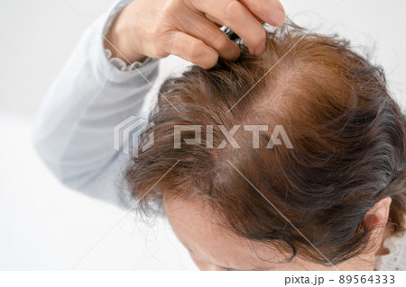 髪を気にする女性　シニア　薄毛 89564333