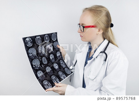 Epileptologist examines patient MRI and electroencephalogram. Concept treating epilepsy and helping people who suffer from this disease. Neurologist at work. Pathology of the brain. Seizure activity Epileptologist examines patient MRI and electroencephalogram. Concept treating epilepsy and helping people who suffer from this disease. Neurologist at work. Pathology of the brain. Seizure activity 89575768