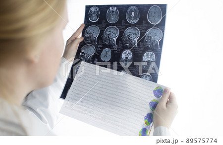 Epileptologist examines patient MRI and electroencephalogram. Concept treating epilepsy and helping people who suffer from this disease. Neurologist at work. Pathology of the brain. Seizure activity 89575774