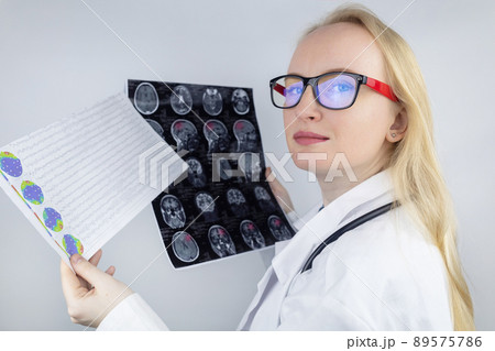 Epileptologist examines patient MRI and electroencephalogram. Concept treating epilepsy and helping people who suffer from this disease. Neurologist at work. Pathology of the brain. Seizure activity 89575786