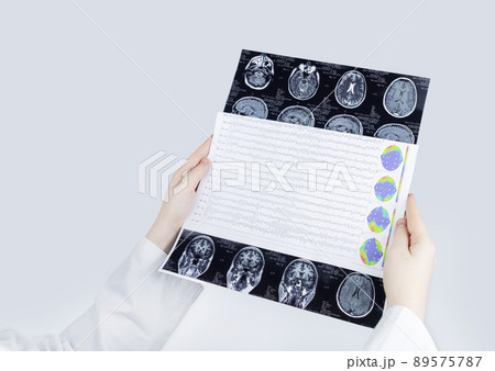 Epileptologist examines patient MRI and electroencephalogram. Concept treating epilepsy and helping people who suffer from this disease. Neurologist at work. Pathology of the brain. Seizure activity 89575787
