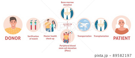 Bone marrow donation medical poster info graphic Bone marrow donation medical poster info graphic 89582197