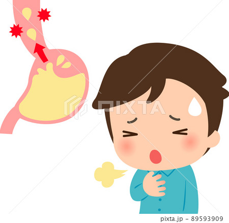 逆流性食道炎の症状に苦しむ若い男性 89593909