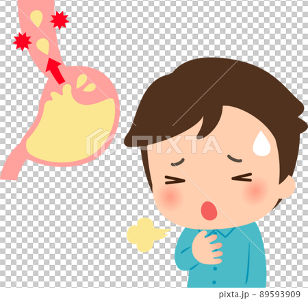 逆流性食道炎の症状に苦しむ若い男性 89593909