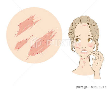 アレルギー、敏感肌に悩む可愛い女性 89598047