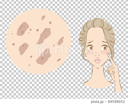 一個患有斑點雀斑的可愛女人 89598052