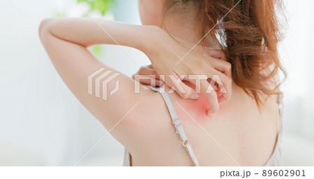 woman scratches her back woman scratches her back 89602901