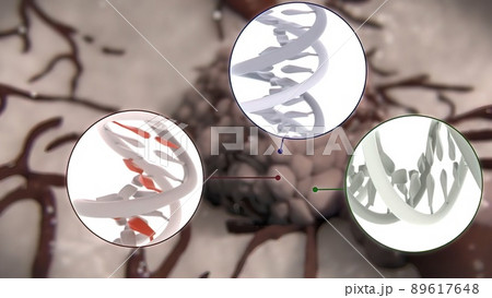 Division and growth of cancerous cells 89617648